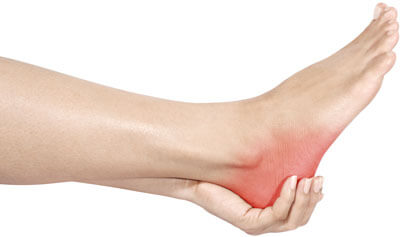 Plantar Fasciitis: What a Pain in the Heel!
