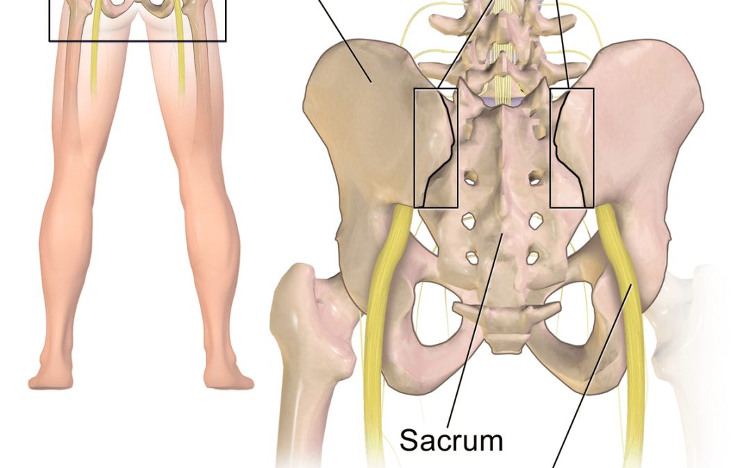 Is it Hip Pain or Sacroiliac Joint Pain? : Physical Therapists Know